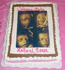 Baby Shower Cake with Ultrasound Picture