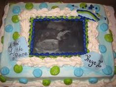 Baby Shower Cake with Ultrasound