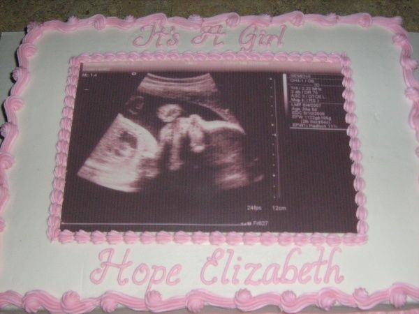 Baby Shower Sheet Cakes with Ultrasound Picture