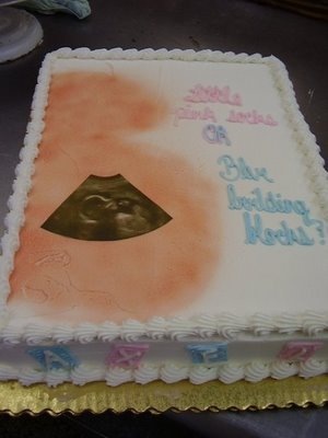 Gender Reveal Cakes with Ultrasound