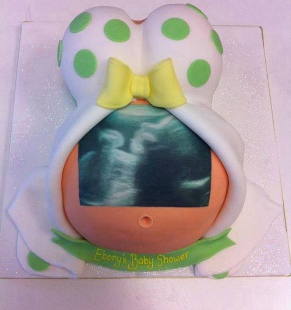 Ultrasound Cakes Baby Shower Ideas